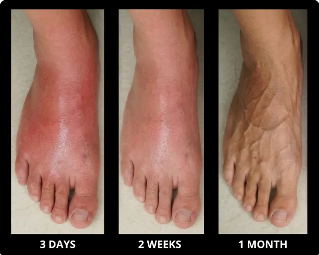 Before and after results